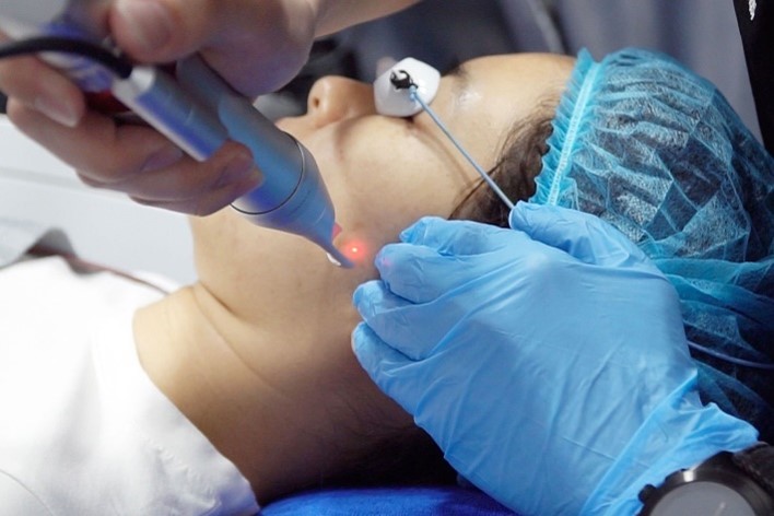 One Doc - Laser Facial Treatment 